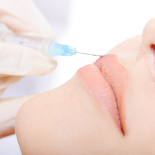 Evolve Health's Aesthetics and Botox professionally applying BOTOX with a small needle to a womans lips. The professionalism of Evolve Health's staff minimizing the pain and swelling.