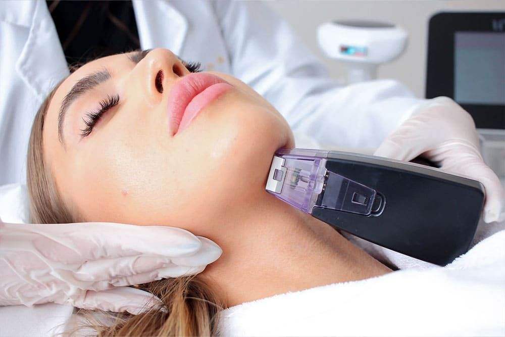 morpheus lumecca ipl photo facial