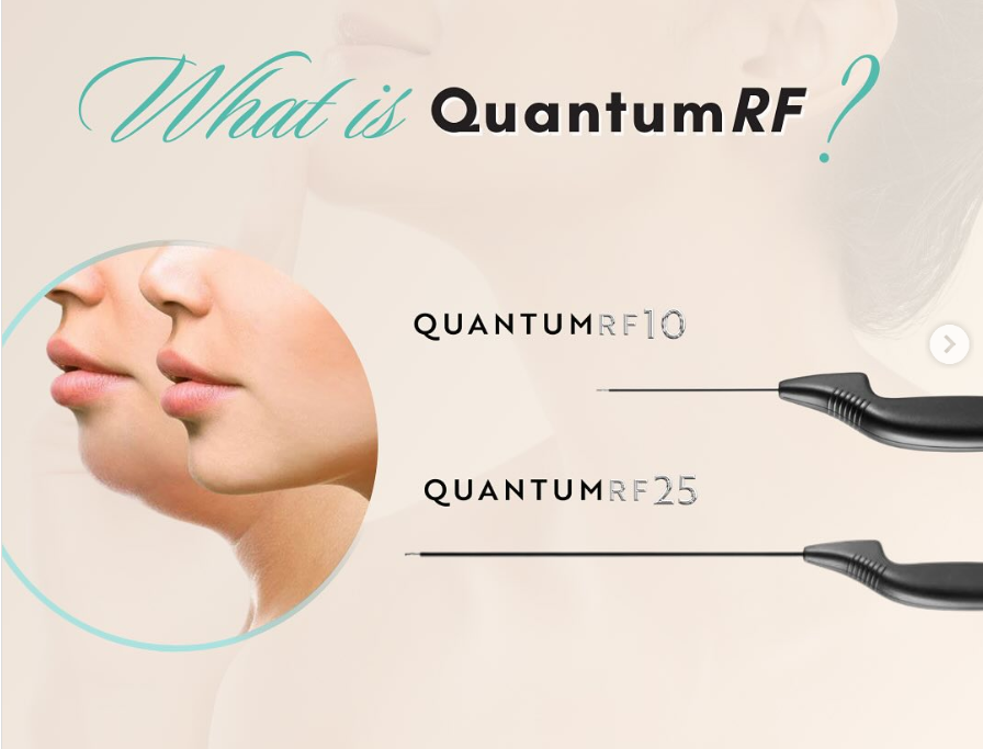 quantum body contouring minimally invasive