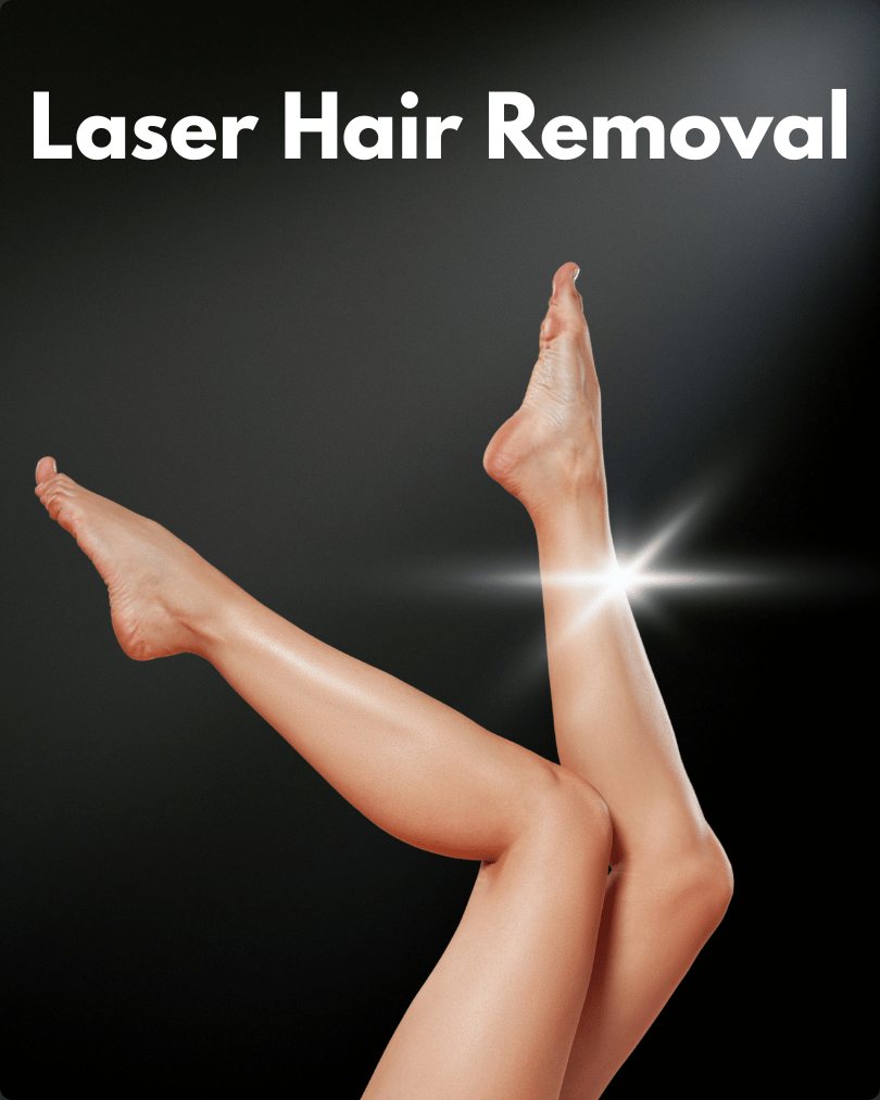Laser Hair Removal